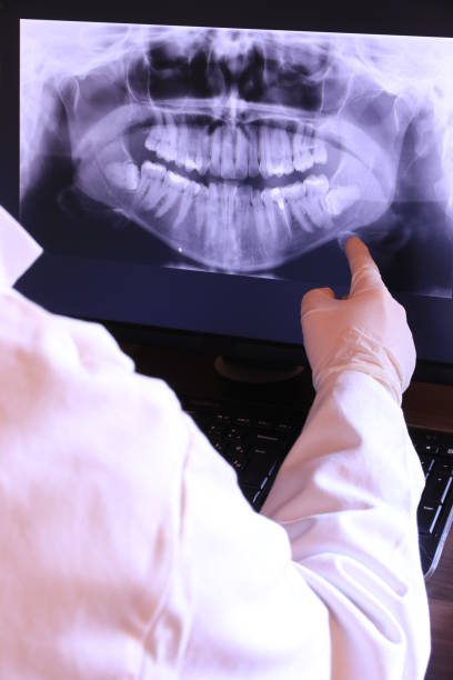 Best Emergency Tooth Extraction in Forest, VA