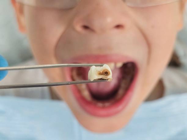 Best Walk-In Emergency Dentist in Forest, VA